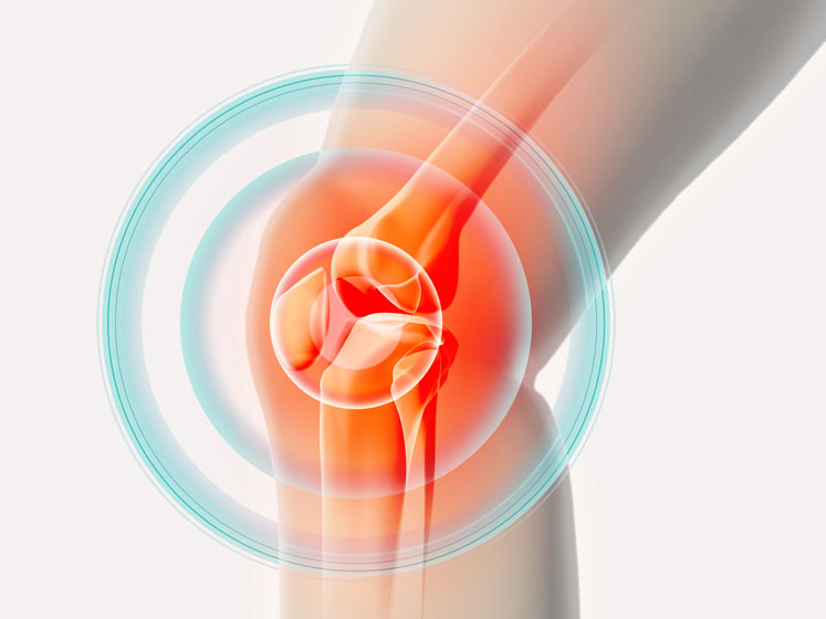knee painful skeleton x ray.